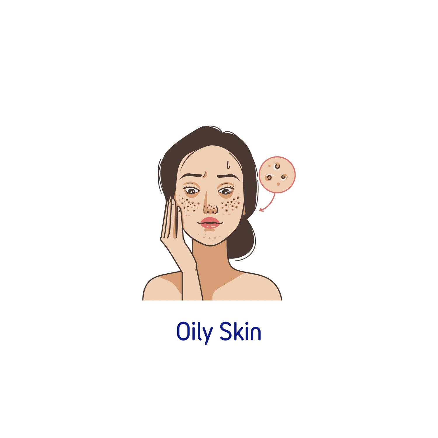Oily Skin